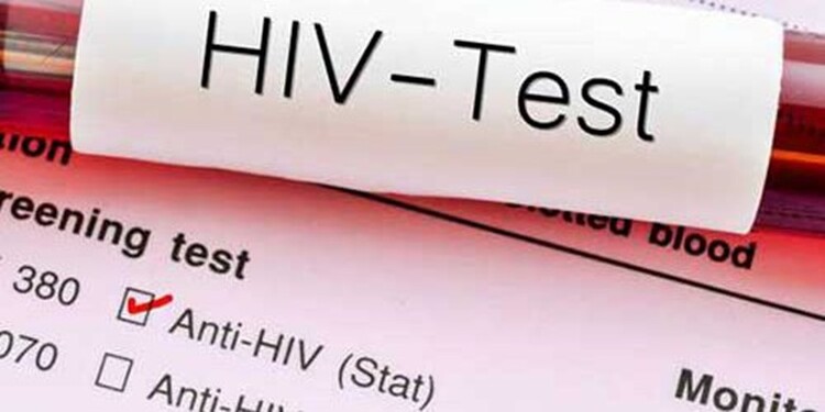 آزمایش HIV